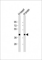 BRCC3 / BRCC36 Antibody - All lanes: Anti-BRCC3 Antibody (N-Term) at 1:1000 dilution. Lane 1: human heart lysate. Lane 2: human brain lysate Lysates/proteins at 20 ug per lane. Secondary Goat Anti-Rabbit IgG, (H+L), Peroxidase conjugated at 1:10000 dilution. Predicted band size: 36 kDa. Blocking/Dilution buffer: 5% NFDM/TBST.