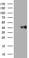 BRCC3 / BRCC36 Antibody - HEK293T cells were transfected with the pCMV6-ENTRY control. (Left lane) or pCMV6-ENTRY BRCC3. (Right lane) cDNA for 48 hrs and lysed. Equivalent amounts of cell lysates. (5 ug per lane) were separated by SDS-PAGE and immunoblotted with anti-BRCC3. (1:500)