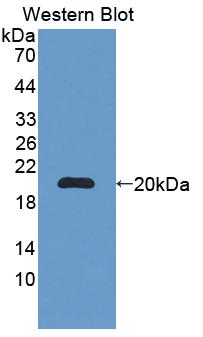 BRCC3 / BRCC36 Antibody - Western blot of BRCC3 / BRCC36 antibody.