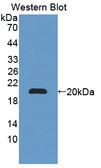 BRCC3 / BRCC36 Antibody - Western blot of BRCC3 / BRCC36 antibody.