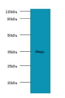 BRCC3 / BRCC36 Antibody - Western blot of Lys-63-specific deubiquitinase BRCC36 antibody at 2 ug/ml with HeLa whole cell lysate. Secondary: Goat polyclonal to Rabbit IgG at 1:15000 dilution. Predicted band size: 36 KDa. Observed band size: 36 KDa.  This image was taken for the unconjugated form of this product. Other forms have not been tested.