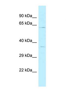 BRCC3 / BRCC36 Antibody - BRCC3 / BRCC36 antibody Western blot of 435S Cell lysate. Antibody concentration 1 ug/ml.  This image was taken for the unconjugated form of this product. Other forms have not been tested.
