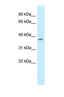 BRCC3 / BRCC36 Antibody - BRCC3 / BRCC36 antibody Western blot of Fetal Heart lysate. Antibody concentration 1 ug/ml.  This image was taken for the unconjugated form of this product. Other forms have not been tested.