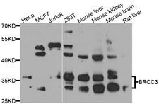 BRCC3 / BRCC36 Antibody - Western blot analysis of extracts of various cell lines.