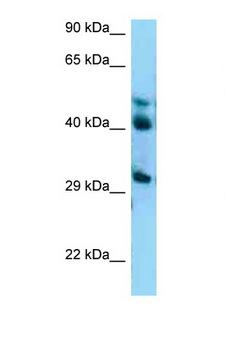 BRCC45 / BRE Antibody - BRE antibody Western blot of A549 Cell lysate. Antibody concentration 1 ug/ml.  This image was taken for the unconjugated form of this product. Other forms have not been tested.