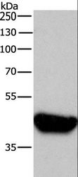 BRCC45 / BRE Antibody - Western blot analysis of A431, using BRE Polyclonal Antibody at dilution of 1:750.