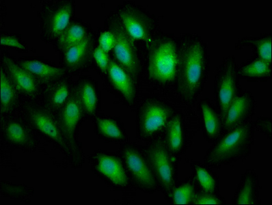 BRCC45 / BRE Antibody - Immunofluorescence staining of Hela cells diluted at 1:66,counter-stained with DAPI. The cells were fixed in 4% formaldehyde, permeabilized using 0.2% Triton X-100 and blocked in 10% normal Goat Serum. The cells were then incubated with the antibody overnight at 4°C.The Secondary antibody was Alexa Fluor 488-congugated AffiniPure Goat Anti-Rabbit IgG (H+L).