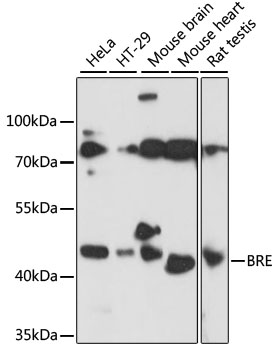 BRCC45 / BRE Antibody - Western blot analysis of extracts of various cell lines, using BRE antibody at 1:1000 dilution. The secondary antibody used was an HRP Goat Anti-Rabbit IgG (H+L) at 1:10000 dilution. Lysates were loaded 25ug per lane and 3% nonfat dry milk in TBST was used for blocking. An ECL Kit was used for detection and the exposure time was 60s.