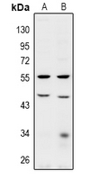 BRCC45 / BRE Antibody - Western blot analysis of BRE expression in HCT116 (A), HEK293T (B) whole cell lysates.