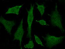 BRCC45 / BRE Antibody - Immunofluorescence staining of BRE in Hela cells. Cells were fixed with 4% PFA, permeabilzed with 0.3% Triton X-100 in PBS, blocked with 10% serum, and incubated with rabbit anti-Human BRE polyclonal antibody (dilution ratio 1:500) at 4°C overnight. Then cells were stained with the Alexa Fluor 488-conjugated Goat Anti-rabbit IgG secondary antibody (green). Positive staining was localized to cytoplasm and nucleus.