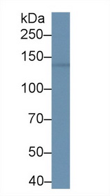 BRD1 Antibody - Western Blot; Sample: Mouse Cerebrum lysate; Primary Ab: 1µg/ml Rabbit Anti-Human BRD1 Antibody Second Ab: 0.2µg/mL HRP-Linked Caprine Anti-Rabbit IgG Polyclonal Antibody