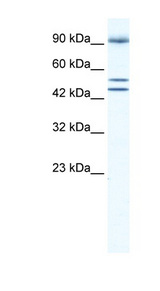 BRD2 / RING3 Antibody - BRD2 antibody Western blot of Jurkat lysate. This image was taken for the unconjugated form of this product. Other forms have not been tested.