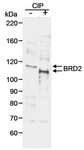 BRD2 / RING3 Antibody - Detection of Human BRD2 by Western Blot. Sample: RIPA extract (10 ug) from HeLa cells that was untreated (-) or treated (+) with CIP (calf intestinal phosphatase). Antibody: Affinity purified goat anti-BRD2 used at 0.05 ug/ml followed by rabbit anti-goat HRP (A50-100P, 1:20000). Detection: Chemiluminescence with 1 minute exposure.