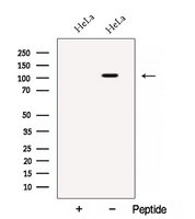 BRD2 / RING3 Antibody - Western blot analysis of extracts of HeLa cells using BRD2 antibody. The lane on the left was treated with blocking peptide.