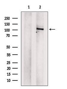 BRD2 / RING3 Antibody