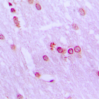 BRD3 Antibody - Immunohistochemical analysis of BRD3 staining in human brain formalin fixed paraffin embedded tissue section. The section was pre-treated using heat mediated antigen retrieval with sodium citrate buffer (pH 6.0). The section was then incubated with the antibody at room temperature and detected using an HRP conjugated compact polymer system. DAB was used as the chromogen. The section was then counterstained with hematoxylin and mounted with DPX.