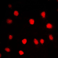 BRD3 Antibody - Immunofluorescent analysis of BRD3 staining in HepG2 cells. Formalin-fixed cells were permeabilized with 0.1% Triton X-100 in TBS for 5-10 minutes and blocked with 3% BSA-PBS for 30 minutes at room temperature. Cells were probed with the primary antibody in 3% BSA-PBS and incubated overnight at 4 C in a humidified chamber. Cells were washed with PBST and incubated with a DyLight 594-conjugated secondary antibody (red) in PBS at room temperature in the dark. DAPI was used to stain the cell nuclei (blue).