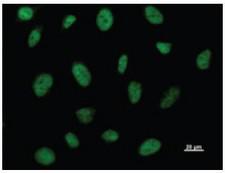BRD3 Antibody - Immunofluorescent staining using BRD3 antibody. Immunostaining analysis in HeLa cells. HeLa cells were fixed with 4% paraformaldehyde and permeabilized with 0.01% Triton-X100 in PBS. The cells were immunostained with anti-BRD3 antibody.