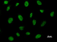 BRD3 Antibody - Immunostaining analysis in HeLa cells. HeLa cells were fixed with 4% paraformaldehyde and permeabilized with 0.1% Triton X-100 in PBS. The cells were immunostained with anti-BRD3 mAb.