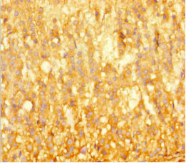 BRD3 Antibody - Immunohistochemistry of paraffin-embedded human adrenal gland tissue at dilution 1:100
