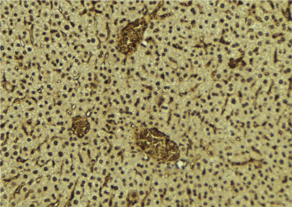 BRD3 Antibody - 1:100 staining mouse liver tissue by IHC-P. The sample was formaldehyde fixed and a heat mediated antigen retrieval step in citrate buffer was performed. The sample was then blocked and incubated with the antibody for 1.5 hours at 22°C. An HRP conjugated goat anti-rabbit antibody was used as the secondary.