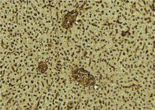 BRD3 Antibody - 1:100 staining mouse liver tissue by IHC-P. The sample was formaldehyde fixed and a heat mediated antigen retrieval step in citrate buffer was performed. The sample was then blocked and incubated with the antibody for 1.5 hours at 22°C. An HRP conjugated goat anti-rabbit antibody was used as the secondary.