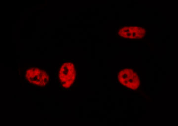 BRD3 Antibody - Staining A549 cells by IF/ICC. The samples were fixed with PFA and permeabilized in 0.1% Triton X-100, then blocked in 10% serum for 45 min at 25°C. The primary antibody was diluted at 1:200 and incubated with the sample for 1 hour at 37°C. An Alexa Fluor 594 conjugated goat anti-rabbit IgG (H+L) Ab, diluted at 1/600, was used as the secondary antibody.
