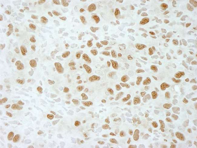 BRD4 Antibody - Detection of Mouse BRD4 by Immunohistochemistry. Sample: FFPE section of mouse teratoma. Antibody: Affinity purified rabbit anti-BRD4 used at a dilution of 1:100. Epitope Retrieval Buffer-High pH (IHC-101J) was substituted for Epitope Retrieval Buffer-Reduced pH.