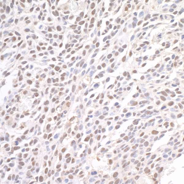 BRD4 Antibody - Detection of mouse BRD4 by immunohistochemistry. Sample: FFPE section of mouse CT26 colon carcinoma. Antibody: Affinity purified rabbit anti-BRD4 used at a dilution of 1:1,000 (1µg/ml). Detection: DAB