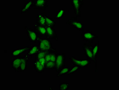 BRD4 Antibody - Immunofluorescence staining of Hela cells with BRD4 Antibody at 1:200, counter-stained with DAPI. The cells were fixed in 4% formaldehyde, permeabilized using 0.2% Triton X-100 and blocked in 10% normal Goat Serum. The cells were then incubated with the antibody overnight at 4°C. The secondary antibody was Alexa Fluor 488-congugated AffiniPure Goat Anti-Rabbit IgG(H+L).