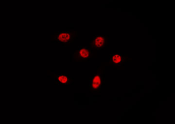 BRD4 Antibody - Staining LOVO cells by IF/ICC. The samples were fixed with PFA and permeabilized in 0.1% Triton X-100, then blocked in 10% serum for 45 min at 25°C. The primary antibody was diluted at 1:200 and incubated with the sample for 1 hour at 37°C. An Alexa Fluor 594 conjugated goat anti-rabbit IgG (H+L) Ab, diluted at 1/600, was used as the secondary antibody.