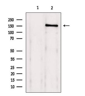 BRD4 Antibody - Western blot analysis of extracts of 293 cells using Brd4 antibody. Lane 1 was treated with the blocking peptide.
