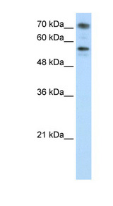 BRD7 Antibody - BRD7 antibody Western blot of Jurkat lysate. This image was taken for the unconjugated form of this product. Other forms have not been tested.