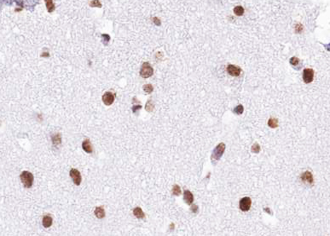 BRD7 Antibody - 1:100 staining human brain tissue by IHC-P. The tissue was formaldehyde fixed and a heat mediated antigen retrieval step in citrate buffer was performed. The tissue was then blocked and incubated with the antibody for 1.5 hours at 22°C. An HRP conjugated goat anti-rabbit antibody was used as the secondary.