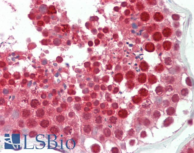 BRD8 Antibody - Anti-BRD8 antibody IHC staining of human testis. Immunohistochemistry of formalin-fixed, paraffin-embedded tissue after heat-induced antigen retrieval. Antibody concentration 10 ug/ml.  This image was taken for the unconjugated form of this product. Other forms have not been tested.