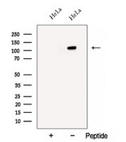 BRD8 Antibody - Western blot analysis of extracts of HeLa cells using BRD8 antibody. The lane on the left was treated with blocking peptide.