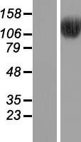 BRD8 Protein - Western validation with an anti-DDK antibody * L: Control HEK293 lysate R: Over-expression lysate