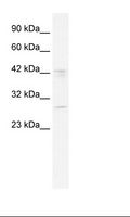 BRD9 Antibody - Jurkat Cell Lysate.  This image was taken for the unconjugated form of this product. Other forms have not been tested.