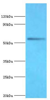 BRD9 Antibody - Western blot. All lanes: Bromodomain-containing protein 9 antibody at 2 ug/ml+mouse liver tissue. Secondary antibody: Goat polyclonal to rabbit at 1:10000 dilution. Predicted band size: 67 kDa. Observed band size: 67 kDa Immunohistochemistry.