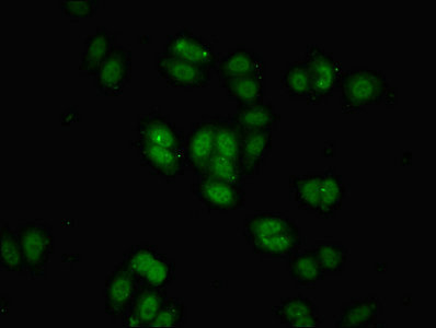 BRD9 Antibody - Immunofluorescent analysis of HepG2 cells using BRD9 Antibody at dilution of 1:100 and Alexa Fluor 488-congugated AffiniPure Goat Anti-Rabbit IgG(H+L)