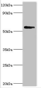 BRD9 Antibody - Western blot All lanes: Bromodomain-containing protein 9 antibody at 2µg/ml + Mouse liver tissue Secondary Goat polyclonal to rabbit IgG at 1/10000 dilution Predicted band size: 68, 23, 54, 27, 56, 61 kDa Observed band size: 68 kDa