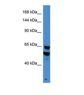 BRD9 Antibody - Western blot of Human HepG2. BRD9 antibody dilution 1.0 ug/ml.  This image was taken for the unconjugated form of this product. Other forms have not been tested.