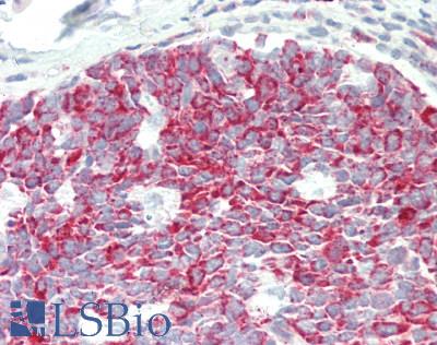 BRD9 Antibody - Human Tonsil: Formalin-Fixed, Paraffin-Embedded (FFPE).  This image was taken for the unconjugated form of this product. Other forms have not been tested.