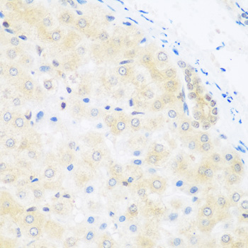 BRD9 Antibody - Immunohistochemistry of paraffin-embedded human liver tissue.