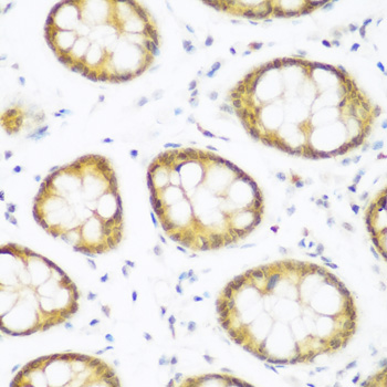 BRD9 Antibody - Immunohistochemistry of paraffin-embedded human colon tissue.