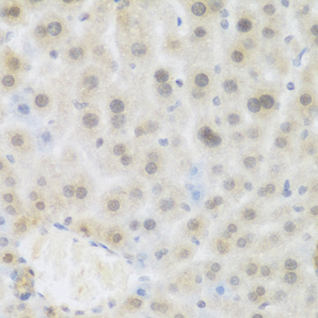 BRD9 Antibody - Immunohistochemistry of paraffin-embedded mouse liver tissue.