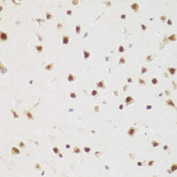 BRD9 Antibody - Immunohistochemistry of paraffin-embedded mouse brain tissue.