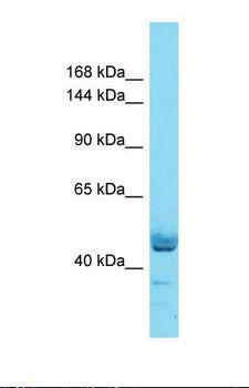 BRDT Antibody - Western blot of Human Thymus Tumor. BRDT antibody dilution 1.0 ug/ml.  This image was taken for the unconjugated form of this product. Other forms have not been tested.