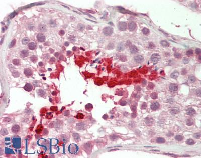 BRDT Antibody - Human Testis: Formalin-Fixed, Paraffin-Embedded (FFPE).  This image was taken for the unconjugated form of this product. Other forms have not been tested.