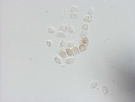 BrdU Antibody - Immunocytochemistry staining of HT-29 cells pulsed with 5-bromo-2'-deoxyuridine (BrdU)using mouse monoclonal anti-BrdU antibody (1:150).